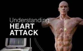 Understanding Heart Attack Oculus Meta Quest VR Game