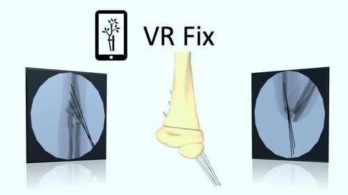 Fix Supra Oculus Meta Quest VR Game<span class="mi-jiaobiao" style="background-color: #ff0000;">Medical VIP</span>